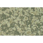 TSINGKE TC‒X0011 B95-8 EBV转化棉顶狨淋巴细胞