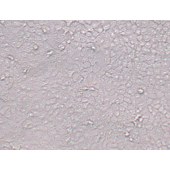 TSINGKE TC‒H0131 Cal-27 人舌鳞癌细胞