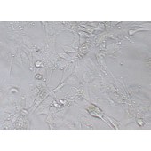 TSINGKE TC‒H0207 SW1088 人脑星形胶质细胞瘤细胞