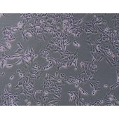 TSINGKE TC‒H0016 HCCC-9810 人胆管细胞型肝癌细胞