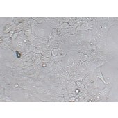 TSINGKE TC‒H0033 HCC827 人非小细胞肺癌细胞