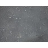 TSINGKE TC‒H0025 NCI-H1975 人非小细胞肺腺癌细胞