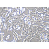 TSINGKE TC‒H0174 22Rv1 人前列腺癌细胞