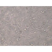 TSINGKE TC‒H0107 HCT-15 人结直肠腺癌上皮细胞