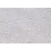 TSINGKE TC‒H0274 SW579 人甲状腺鳞癌细胞