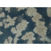 TSINGKE TC‒H0218 Y79 人视网膜母细胞瘤