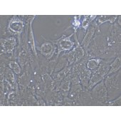 TSINGKE TC‒H0207 SW1088 人脑星形胶质细胞瘤细胞