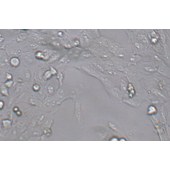 TSINGKE TC‒H0280 KMH-2 人甲状腺癌细胞（退行性）