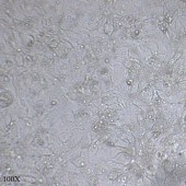 TSINGKE TC‒H0003 Hep3B 人肝癌细胞