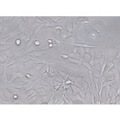 TSINGKE TC‒H0032 Calu-1 人肺癌细胞