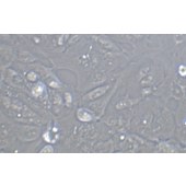 TSINGKE TC‒H0184 ACHN 人肾细胞腺癌细胞