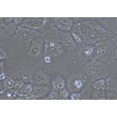 TSINGKE TC‒H0028 NCI-H460 人大细胞肺癌细胞