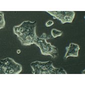 TSINGKE TC‒H0095 NCI-N87 人胃癌细胞