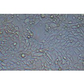 TSINGKE TC‒R0012 Renca 小鼠肾癌细胞