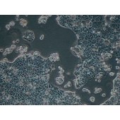 TSINGKE TC‒H0101 Caco-2 人结直肠腺癌细胞