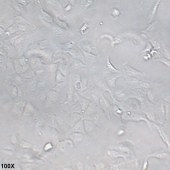TSINGKE TC‒H0018 RBE 人胆管细胞型肝癌细胞