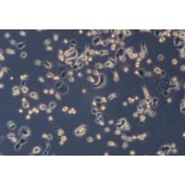 TSINGKE TC‒H0286 AsPC-1 人转移胰腺腺癌细胞(中等至未分化)