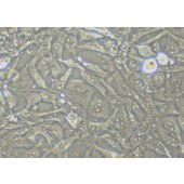 TSINGKE TC‒H0143 ES-2 人卵巢透明细胞癌细胞