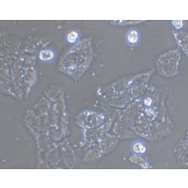 TSINGKE TC‒H0047 NCI-H1703 人肺鳞癌细胞