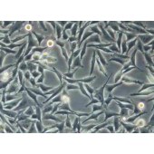 TSINGKE TC‒H0223 A2058 人无黑素性黑色素瘤（淋巴转移）