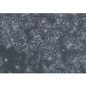 TSINGKE TC‒H0268 SK-N-BE(2) 人神经母细胞瘤细胞