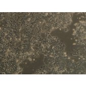TSINGKE TC‒H0071 MDA-MB-415 人乳腺腺癌细胞