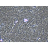 TSINGKE TC‒H0038 HCC4006 人肺癌腺癌细胞