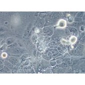 TSINGKE TC‒H0135 SCC-4 人舌鳞癌细胞