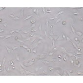 TSINGKE TC‒H0004 SNU-449 人肝癌细胞