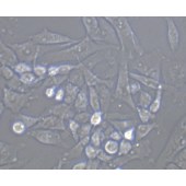 TSINGKE TC‒H0005 SK-HEP-1 人肝腹水腺癌细胞
