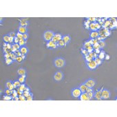 TSINGKE TC‒H0234 HuT 78 人T淋巴细胞白血病细胞