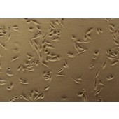 TSINGKE TC‒H0222 SK-MEL-28 人皮肤黑色素瘤细胞