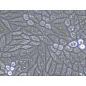 TSINGKE TC‒H0160 SiHa 人子宫颈鳞状细胞癌细胞