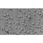 TSINGKE TC‒H0240 ARH-77 人外周血淋巴瘤白血病细胞